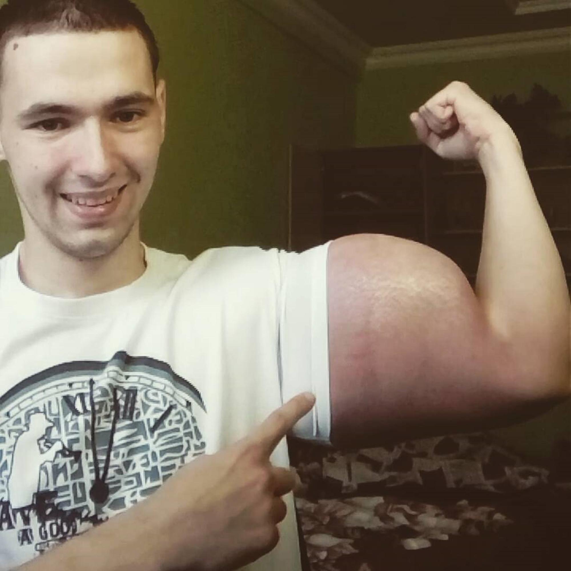 Кирилл Терешин, 21 год, из Пятигорска, расположенного на юго-западе Ставропольского края, делится фотографиями своего странного телосложения в социальных сетях